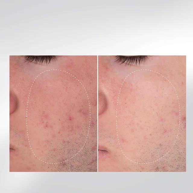 Dermalogica Light Up The Room Gift Set (Worth £92.00)