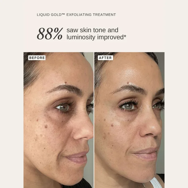 Alpha H Liquid Gold Exfoliating Treatment 30ml