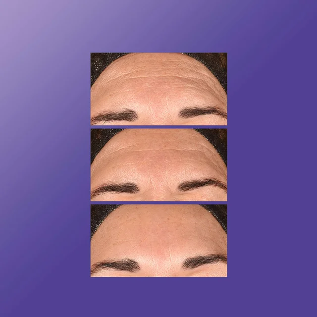 Dermalogica Phyto Nature Exfoliator 100ml